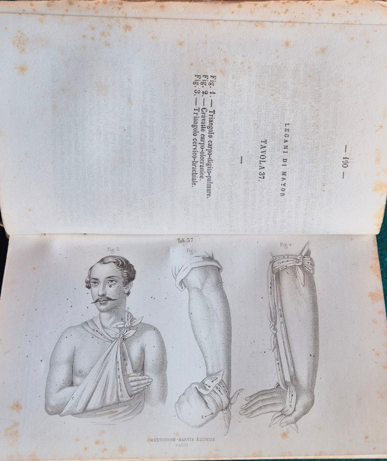Sommario iconografico di fasciature medicature ed apparecchi