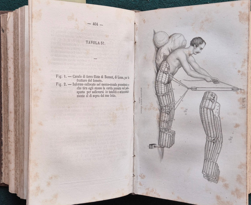 Sommario iconografico di fasciature medicature ed apparecchi