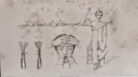 Sommario iconografico di fasciature medicature ed apparecchi