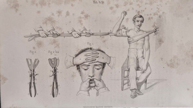 Sommario iconografico di fasciature medicature ed apparecchi