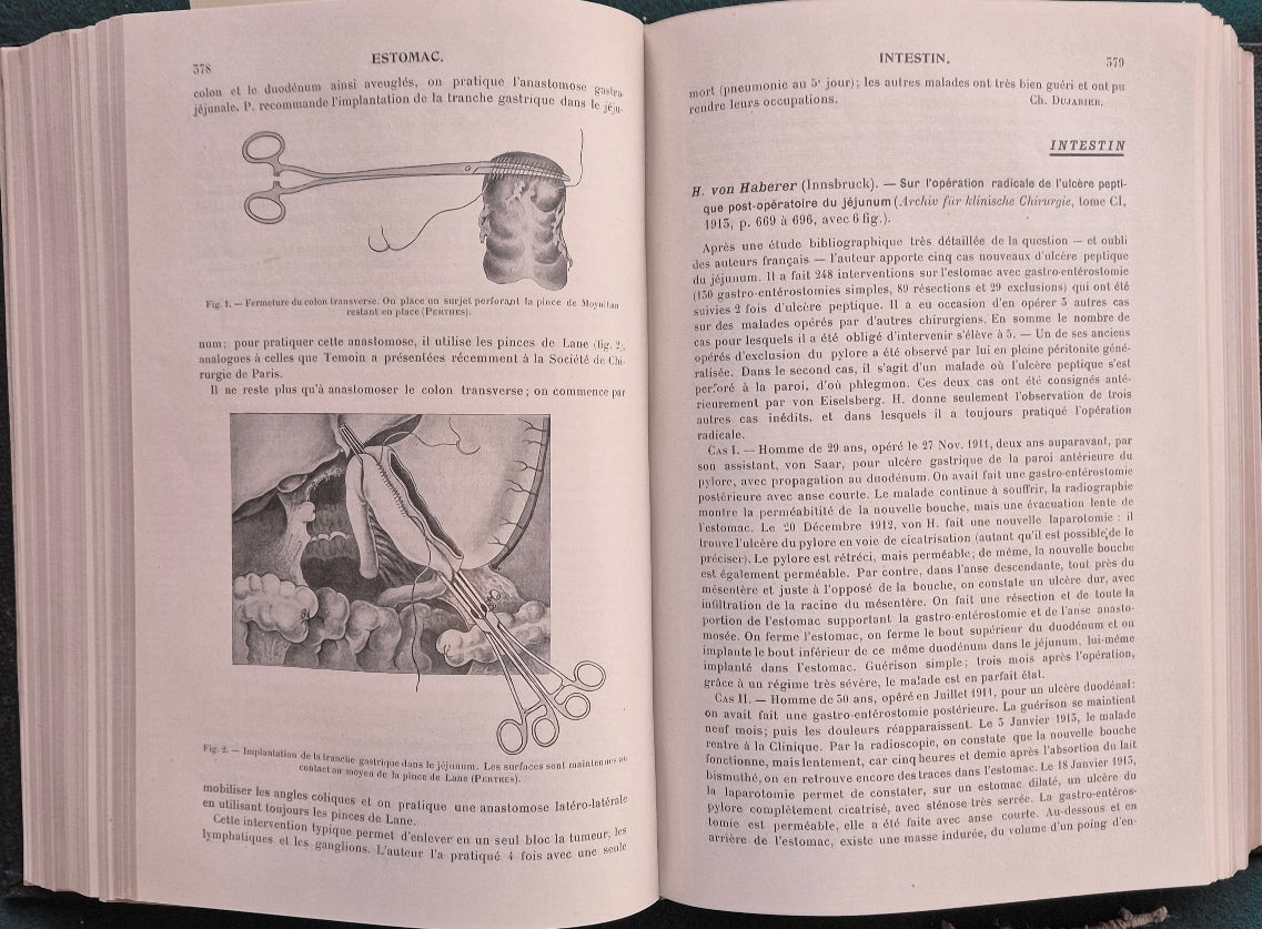 Journal de chirurgie - Tome XI - Juillet-Decembre 1913