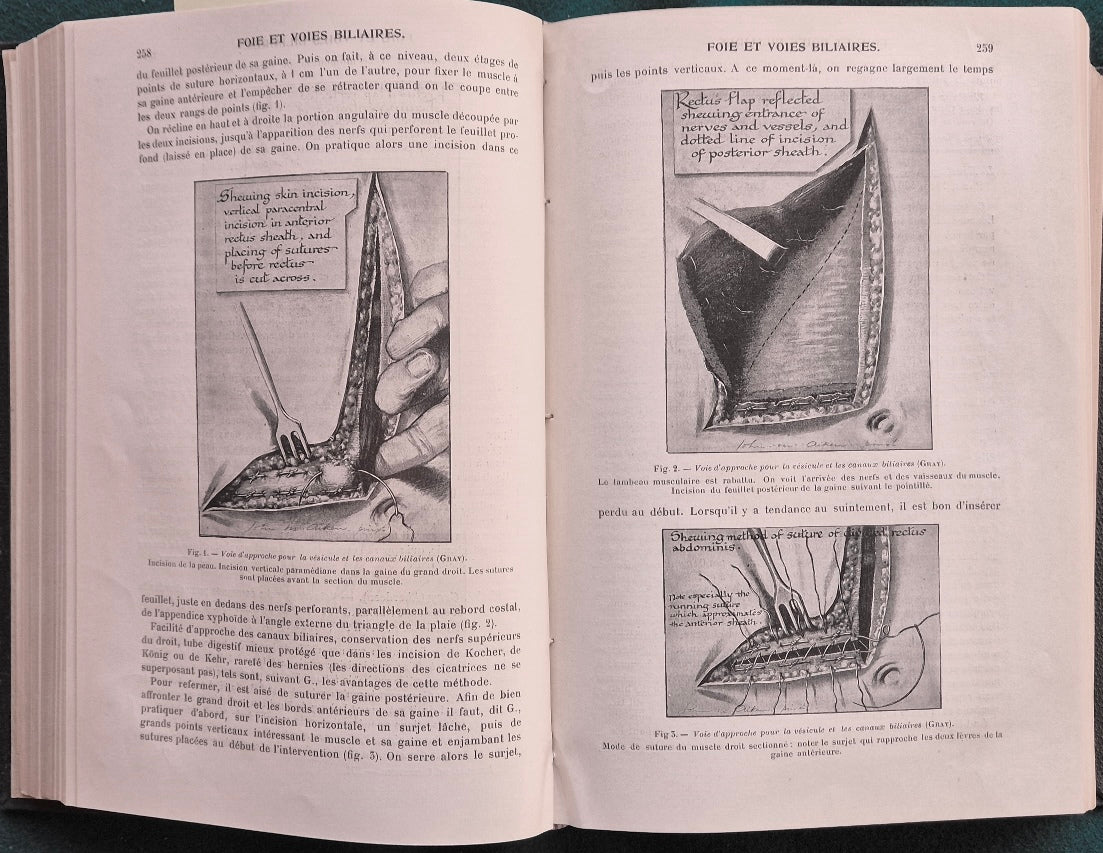 Journal de chirurgie - Tome XII - Janvier-Juin 1914