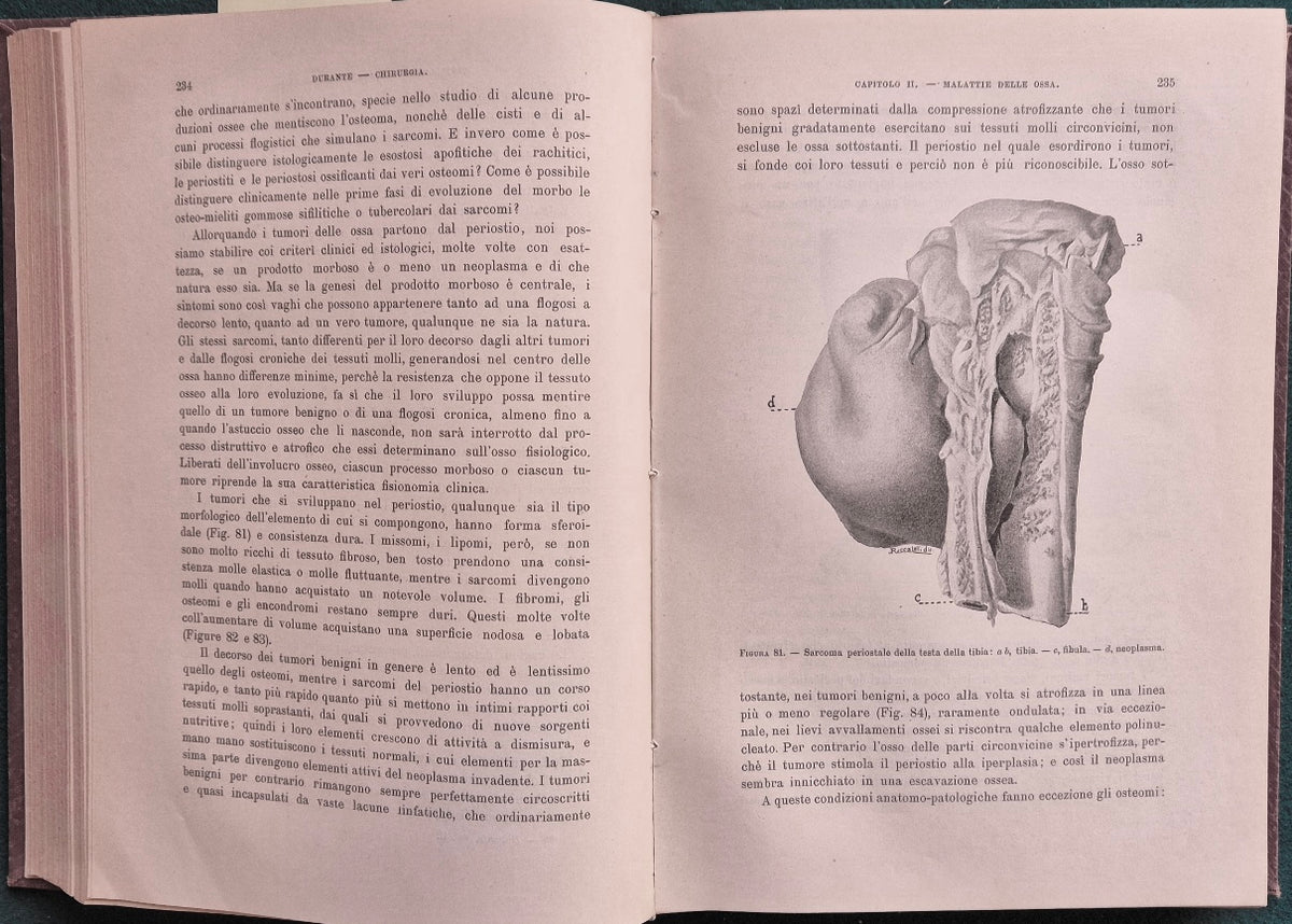 Trattato di patologia e terapia chirurgica generale e speciale - Vol. II