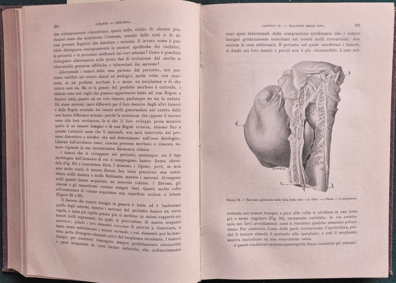 Trattato di patologia e terapia chirurgica generale e speciale - Vol. II