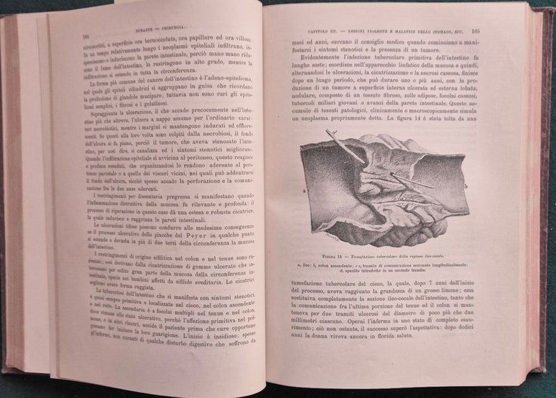 Trattato di patologia e terapia chirurgica generale e speciale - Vol. IV