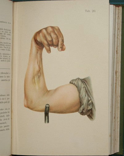 Infortuni. Patologia, terapia e medicina legale degli infortuni e delle malattie consecutive dei trumatizzati
