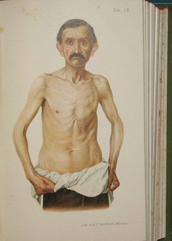 Infortuni. Patologia, terapia e medicina legale degli infortuni e delle malattie consecutive dei trumatizzati