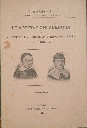 Le vegetazioni adenoidi e la necessità dell'intervento dell'odontojatra e del rinologo