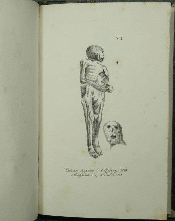 Lecciones de medicina forense del profesor Orfila