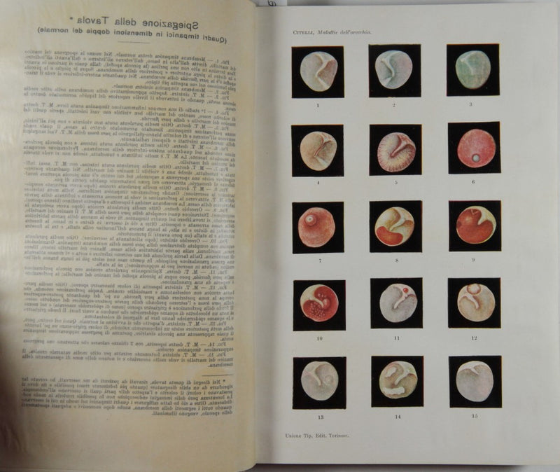 Ear diseases