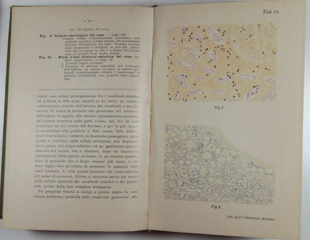 Atlante e manuale di Istologia patologica speciale