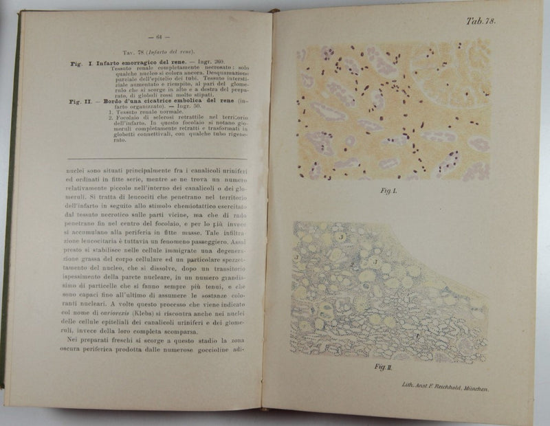 Atlante e manuale di Istologia patologica speciale