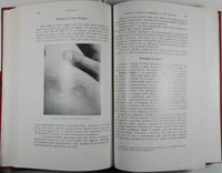 Malattie cutanee