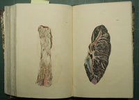 Traitè de l'auscultation mediate et des ailments des poumons et du coeur