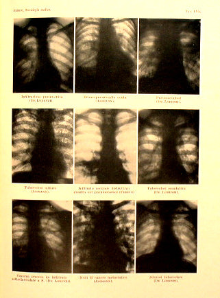 Semiotics of internal diseases