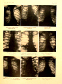 Semiotics of internal diseases