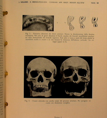 Treatise on odontostomatology and prosthetics