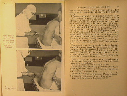 La chirurgia.